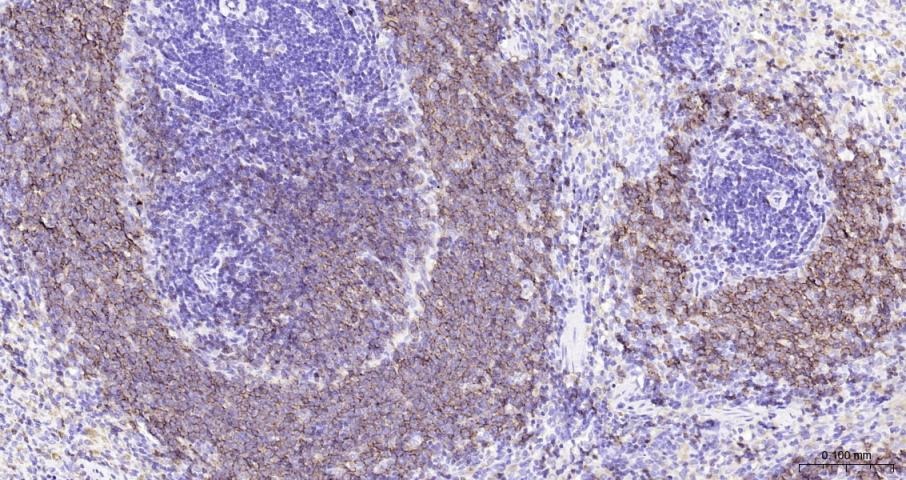 Anti-CD20 Antibody (1R324)