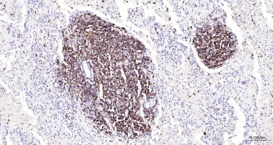 Anti-CD20 Antibody (1R324)