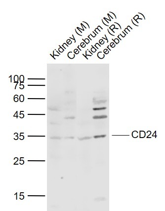 Anti-CD24 Polyclonal Antibody 2