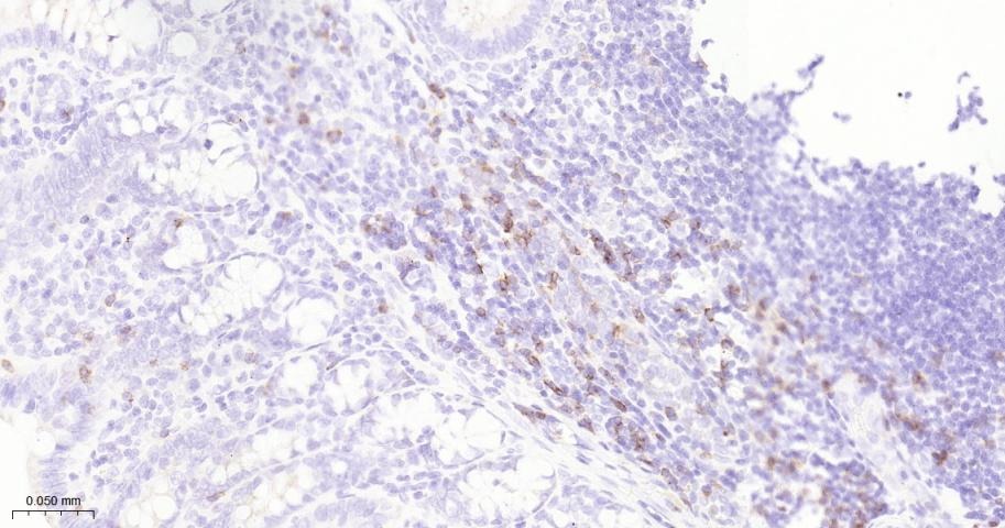 Anti-CD8 alpha Polyclonal Antibody 2