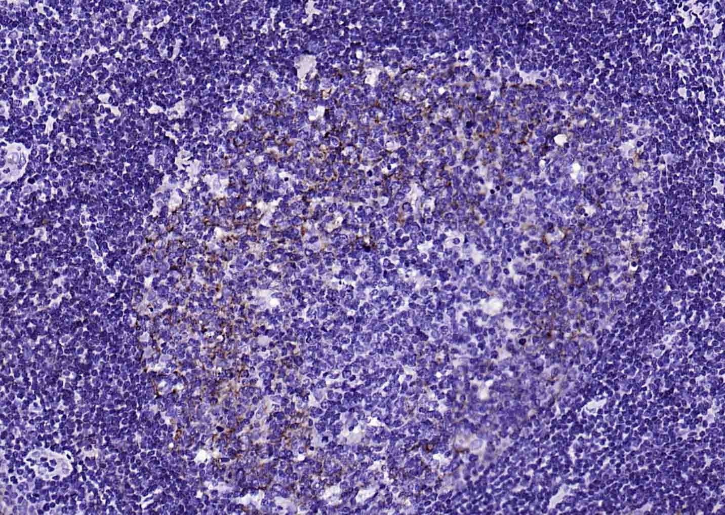 Anti-CD23 Antibody (4R869)