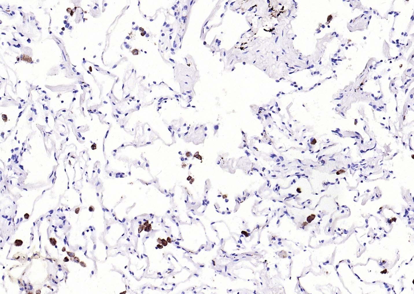 Anti-CD68 Polyclonal Antibody