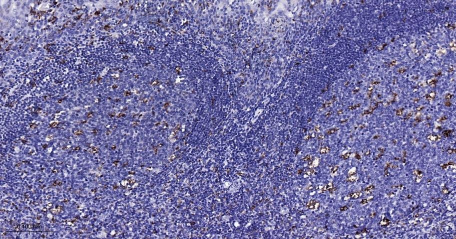 Anti-CD68 Antibody (2P747)