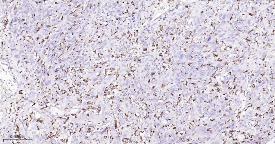 Anti-CD68 Antibody (2P747)