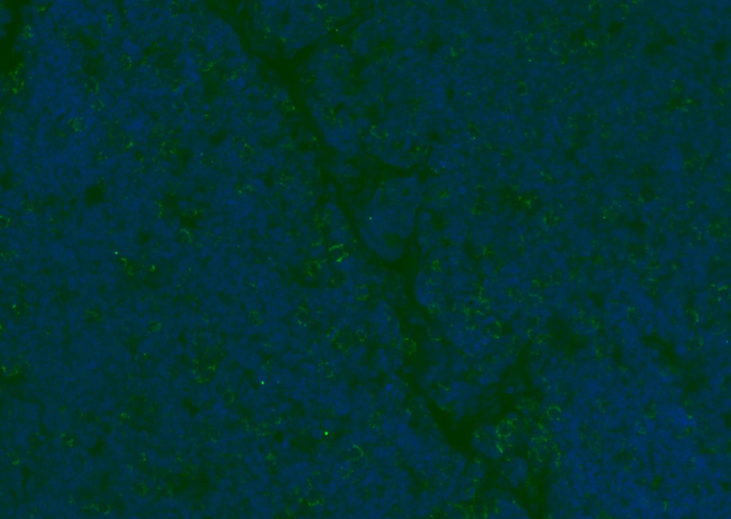 Anti-CD8 beta Polyclonal Antibody