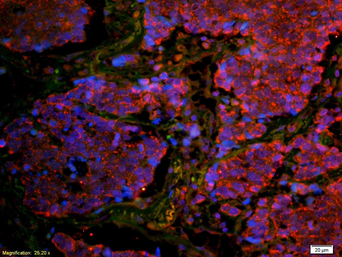 Anti-CD8 beta Polyclonal Antibody