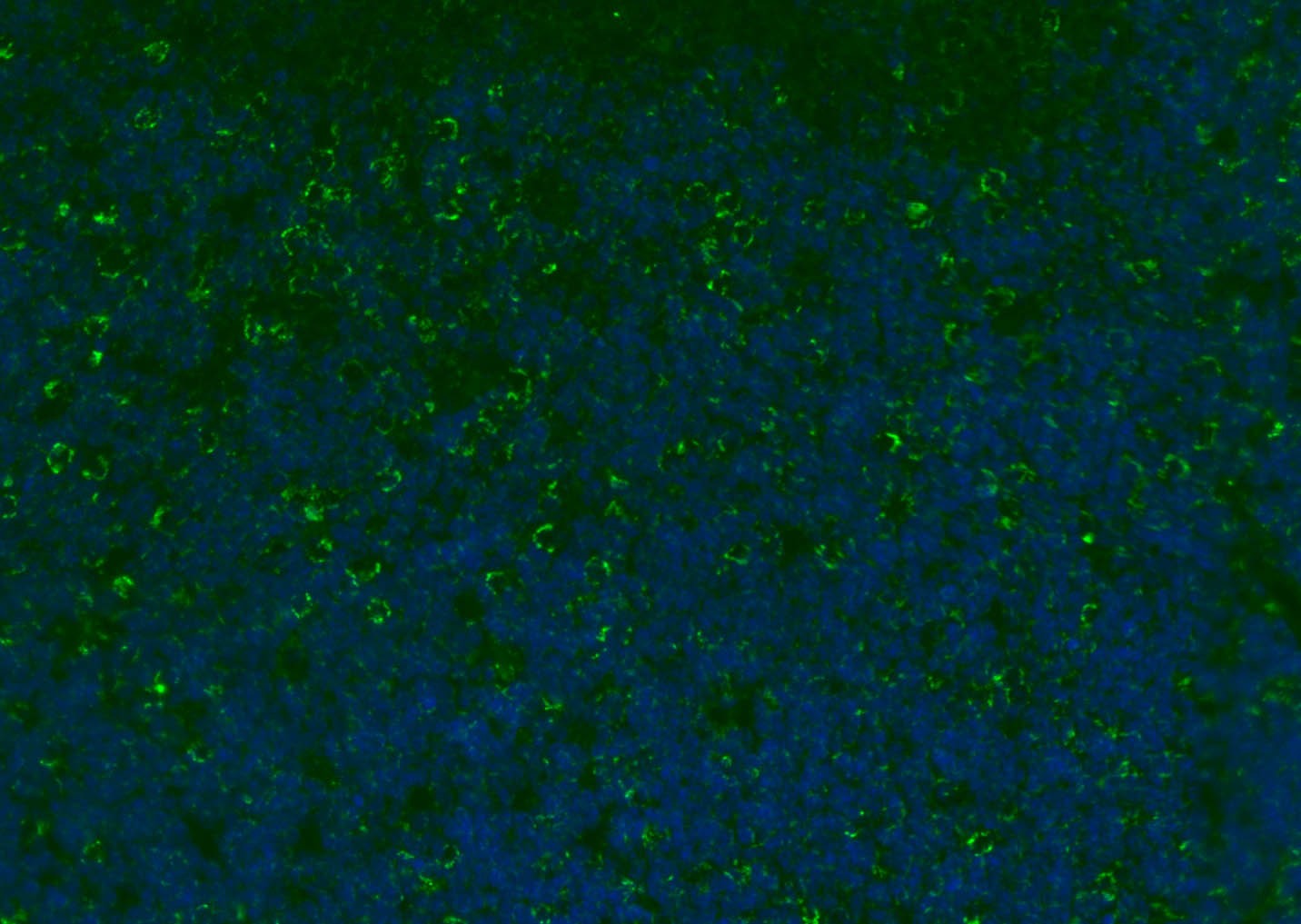 Anti-CD8 beta Polyclonal Antibody