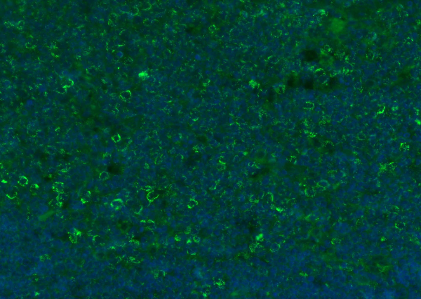 Anti-CD8 beta Polyclonal Antibody