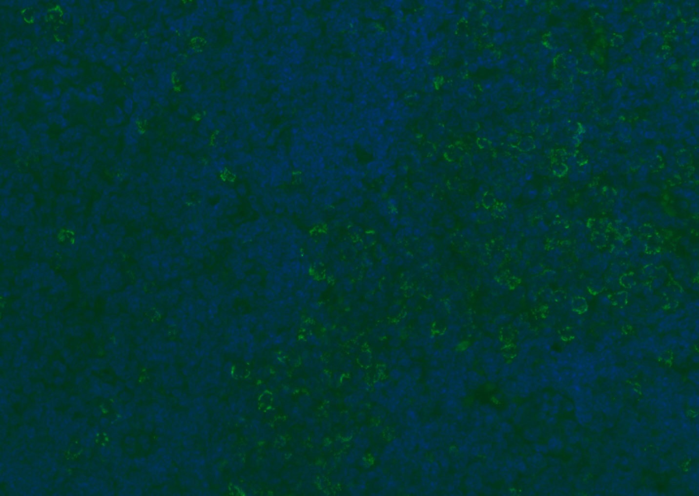 Anti-CD8 beta Polyclonal Antibody