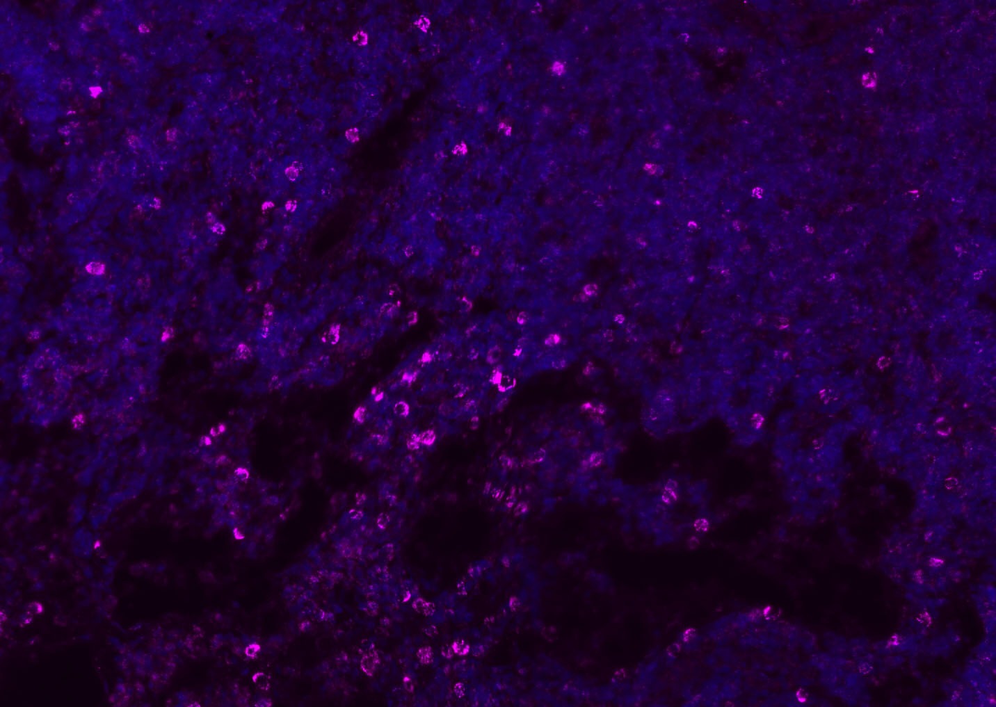 Anti-CD8 beta Polyclonal Antibody