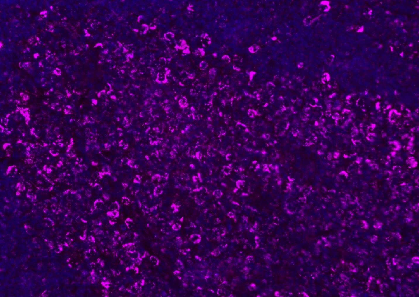 Anti-CD8 beta Polyclonal Antibody