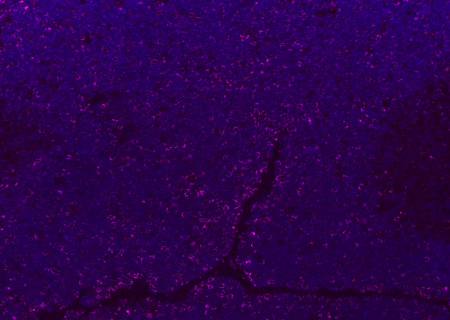 Anti-CD8 beta Polyclonal Antibody