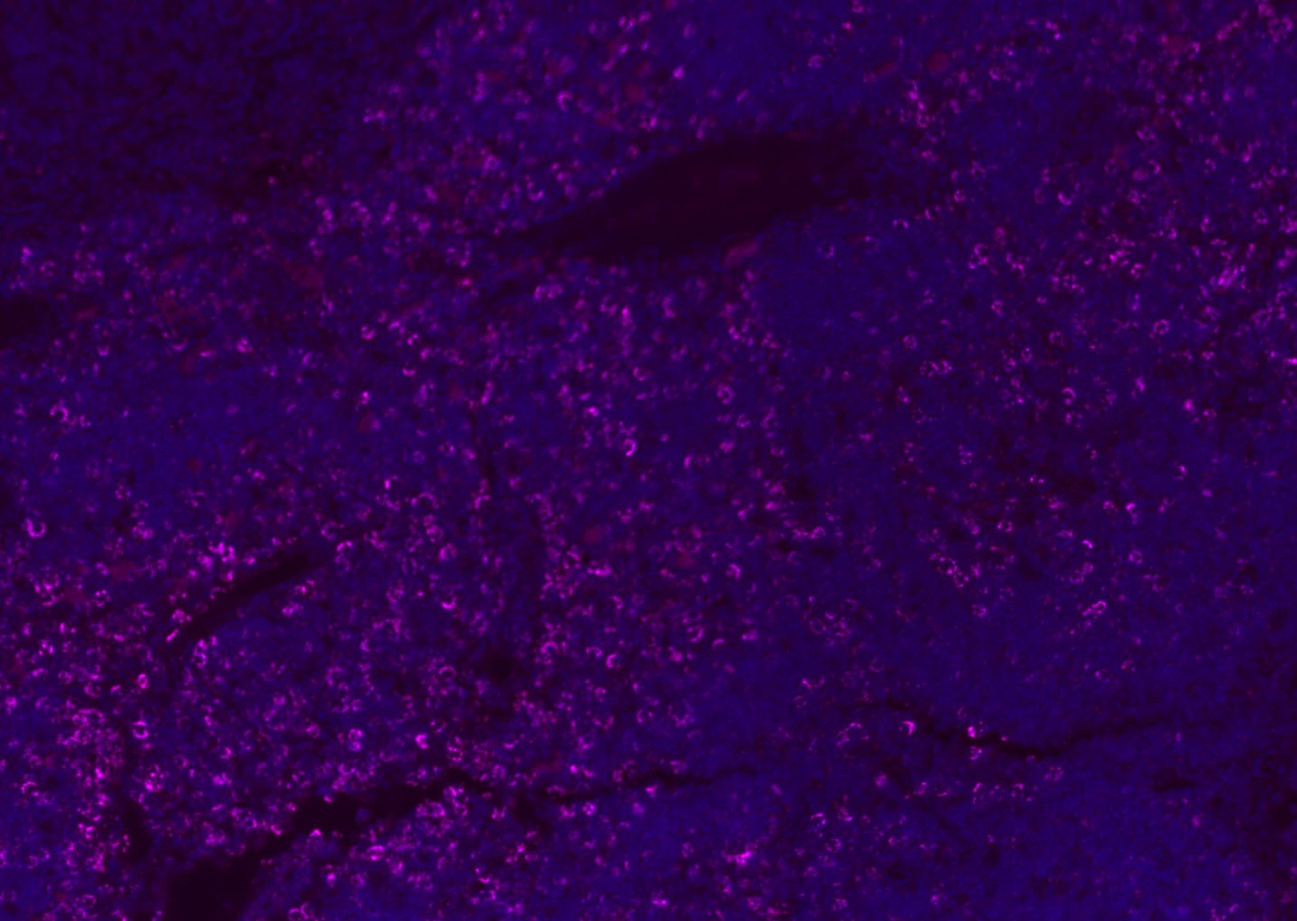 Anti-CD8 beta Polyclonal Antibody