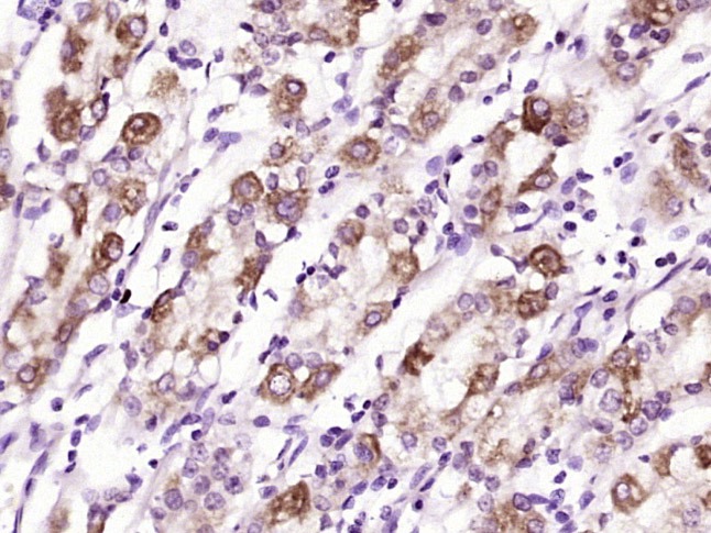 Anti-GCGR Polyclonal Antibody