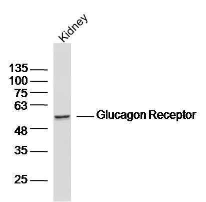 Anti-GCGR Polyclonal Antibody