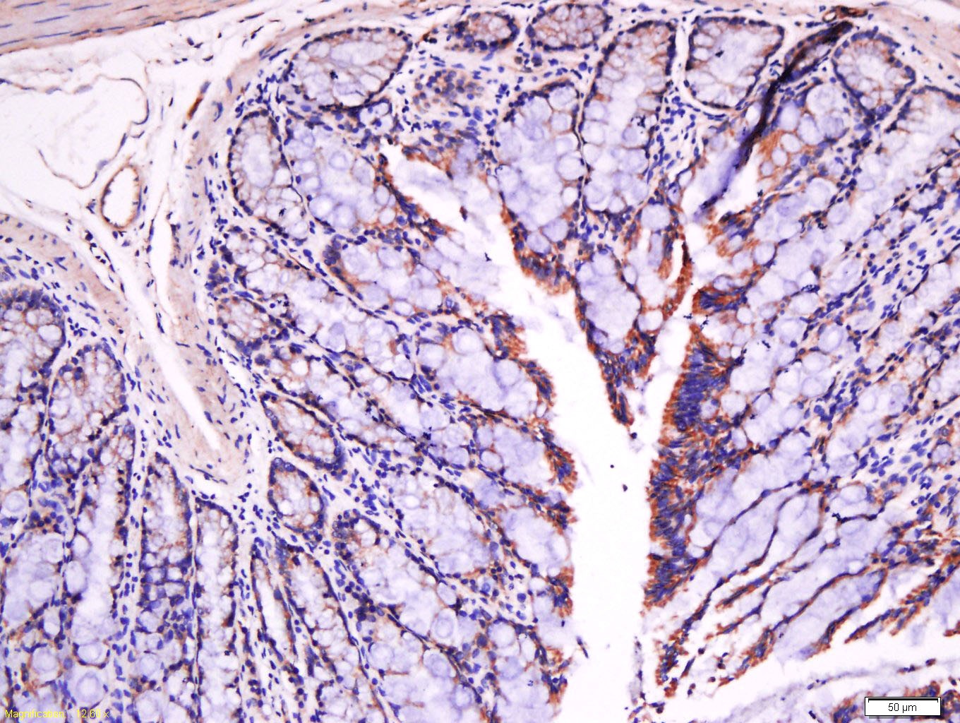 Anti-Fibronectin Polyclonal Antibody