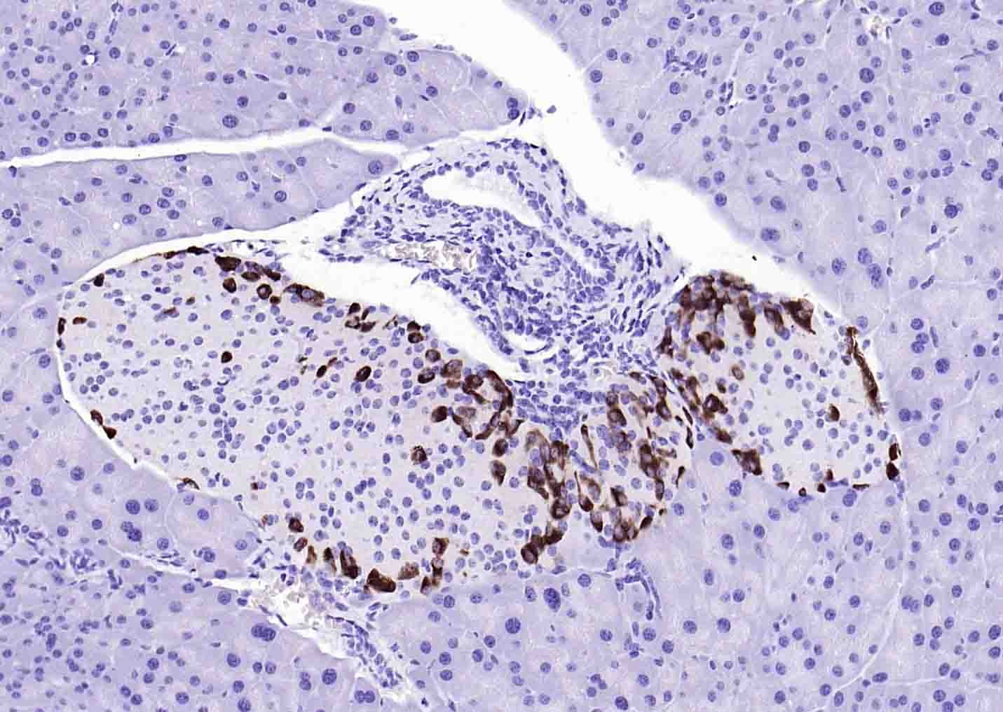 Anti-GCG Polyclonal Antibody 2