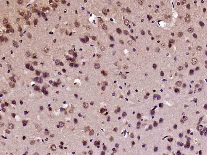 Anti-FOS Polyclonal Antibody