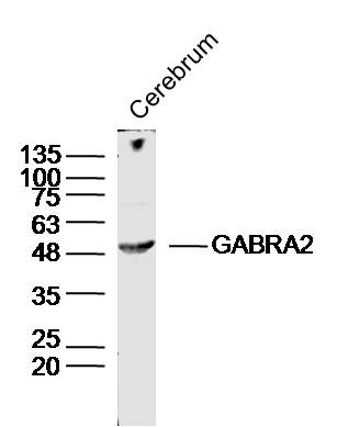 Anti-GABRA2 Polyclonal Antibody