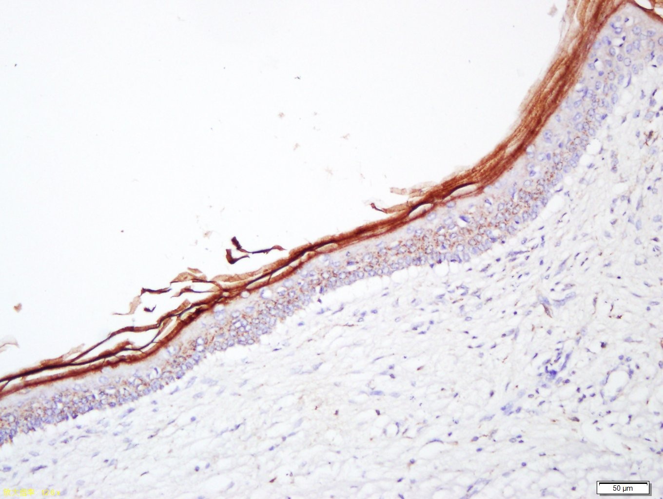 Anti-Filaggrin Polyclonal Antibody