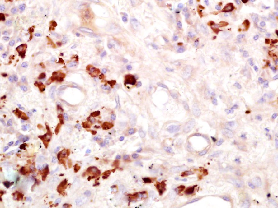 Anti-FUT4 Polyclonal Antibody