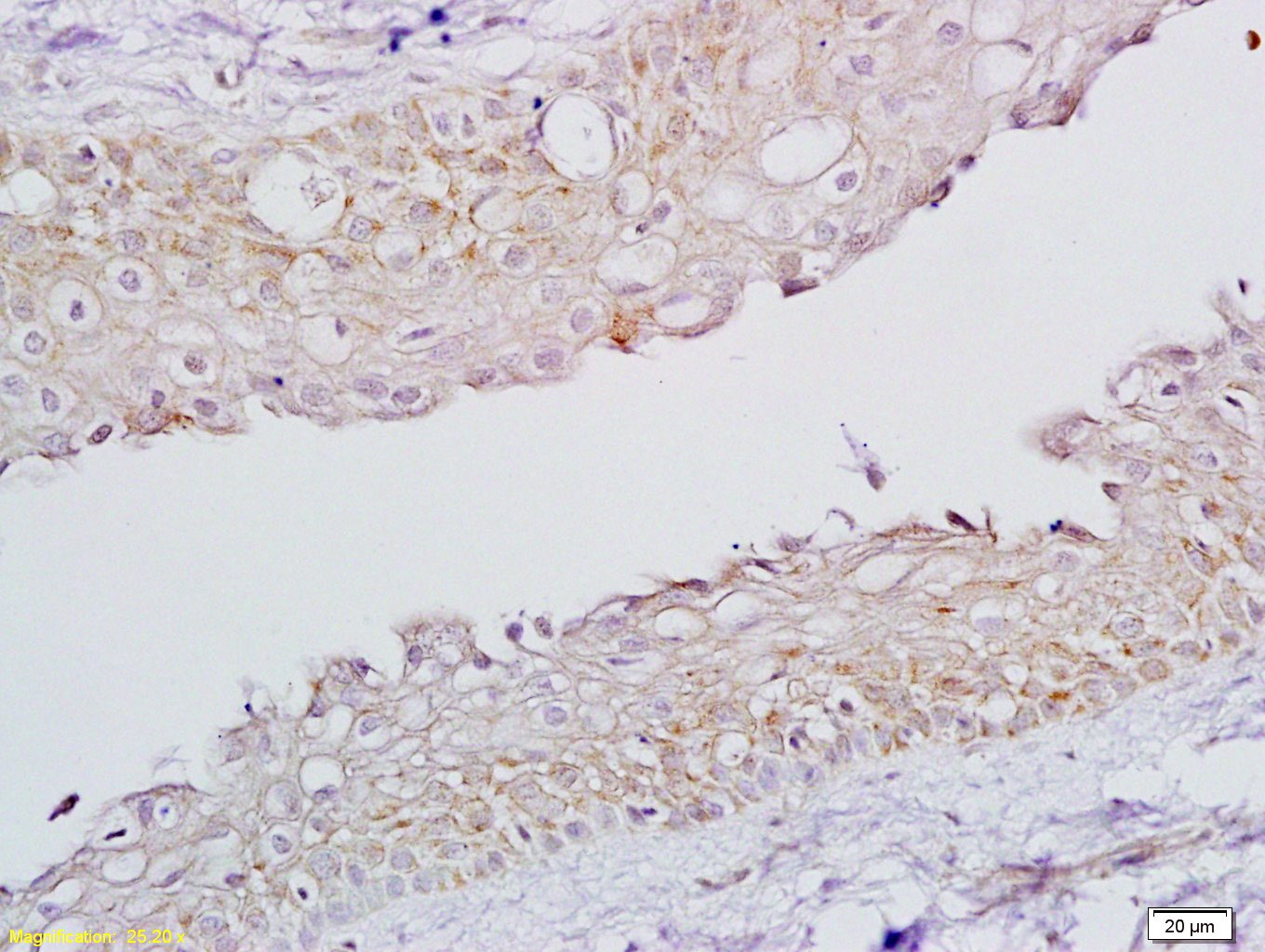 Anti-FSHR Polyclonal Antibody