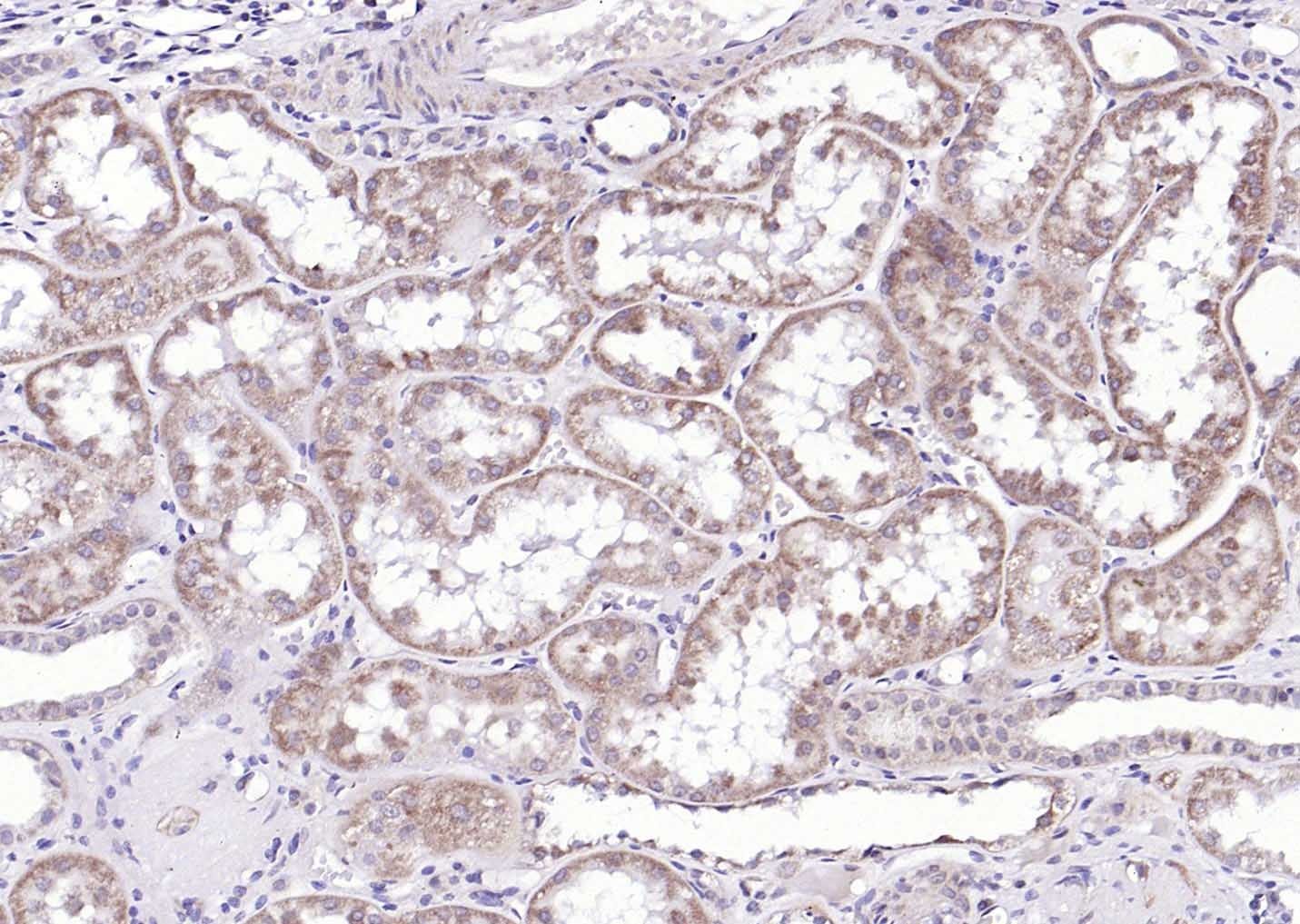Anti-G6PC Polyclonal Antibody
