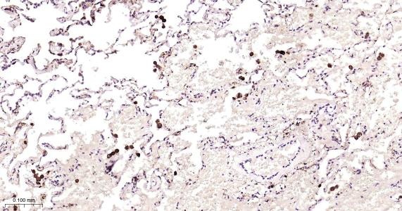 Anti-FTH Antibody (9C880)