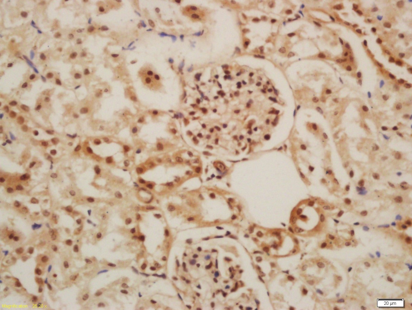 Anti-GLIS3 Polyclonal Antibody
