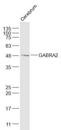 Anti-GABRA2 Polyclonal Antibody