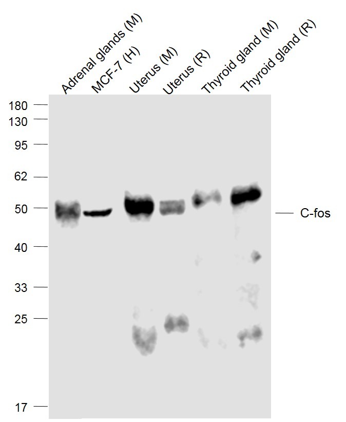 Anti-FOS Antibody (4X378)