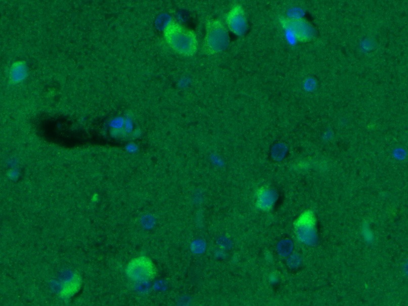 Anti-GABA A Receptor gamma 2 Polyclonal Antibody