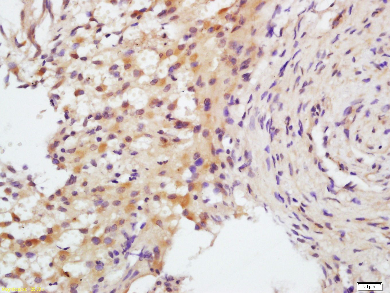 Anti-FSHR Polyclonal Antibody