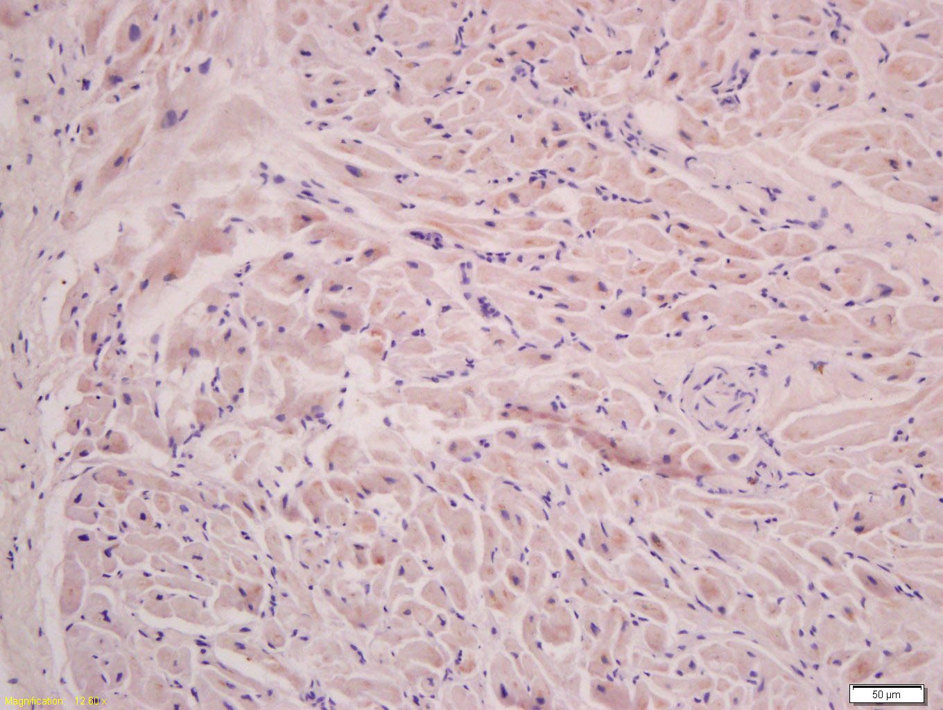 Anti-FLNC Polyclonal Antibody
