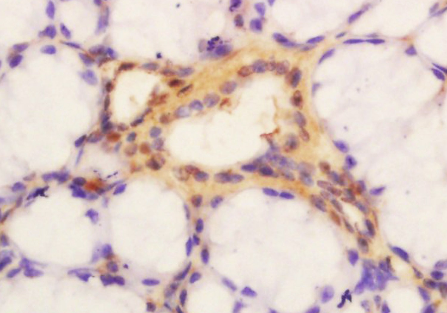 Anti-GLIS3 Polyclonal Antibody