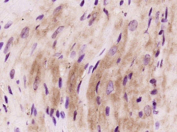 Anti-FLNC Polyclonal Antibody