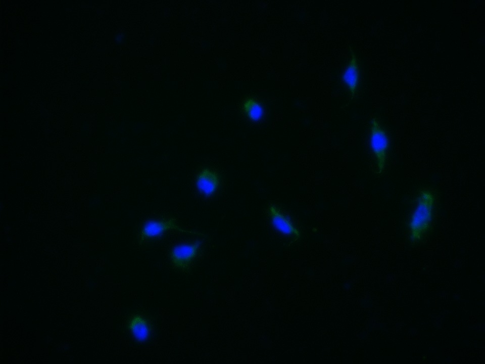 Anti-GABA A Receptor gamma 2 Polyclonal Antibody