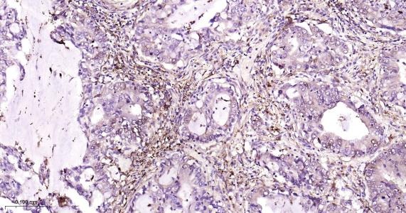 Anti-FTH Antibody (9C880)