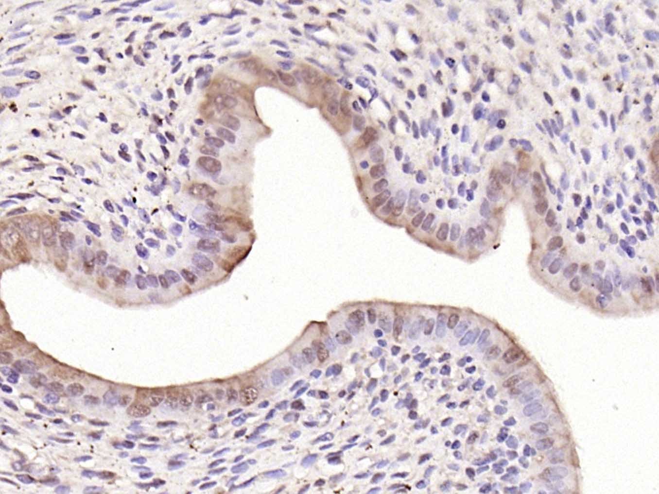 Anti-FOS Polyclonal Antibody