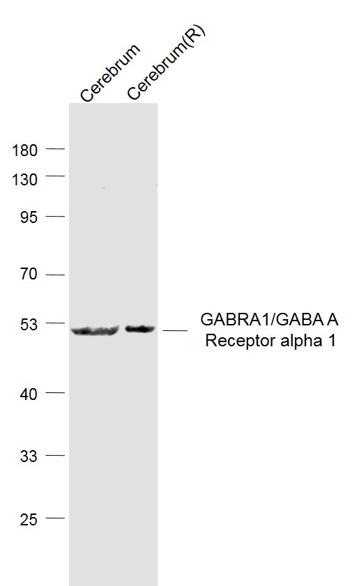 Anti-GABRA1 Polyclonal Antibody