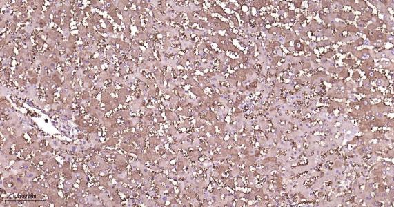 Anti-FTH Antibody (9C880)