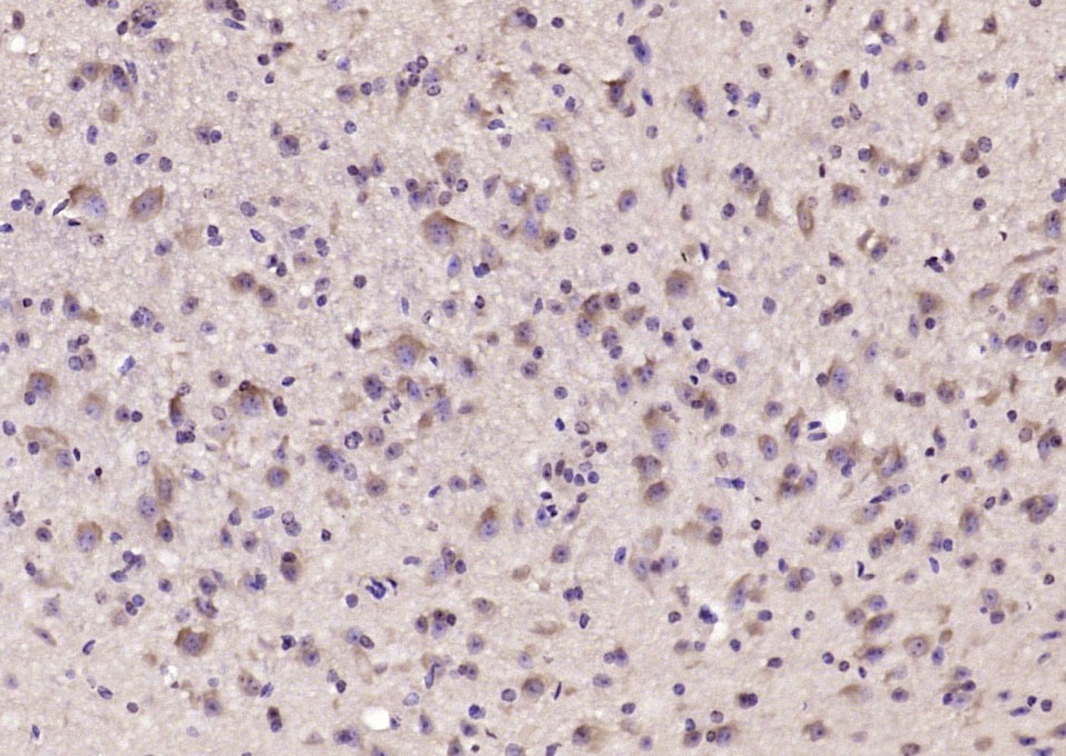 Anti-GABRA1 Polyclonal Antibody