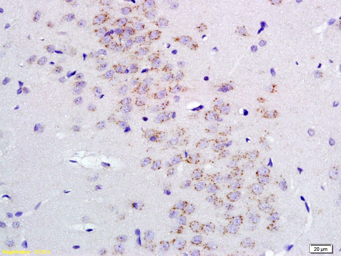 Anti-GABRA2 Polyclonal Antibody
