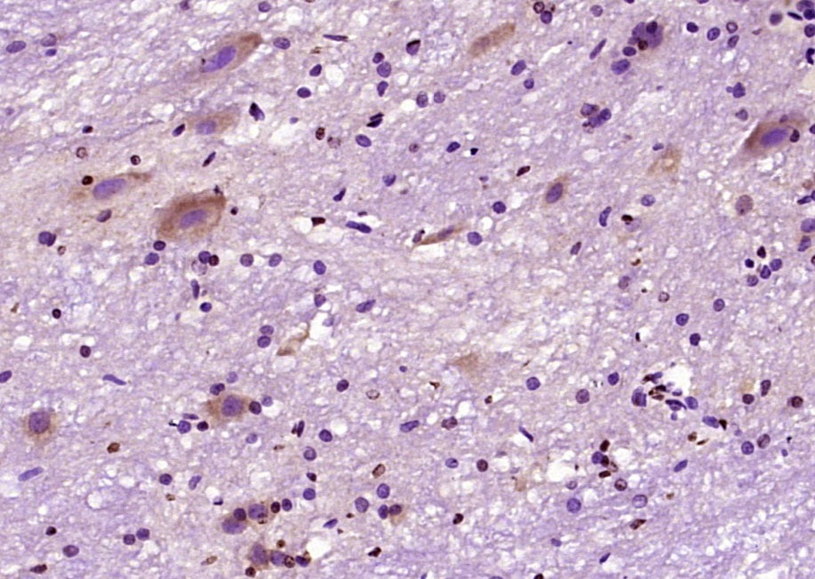 Anti-FOS Polyclonal Antibody
