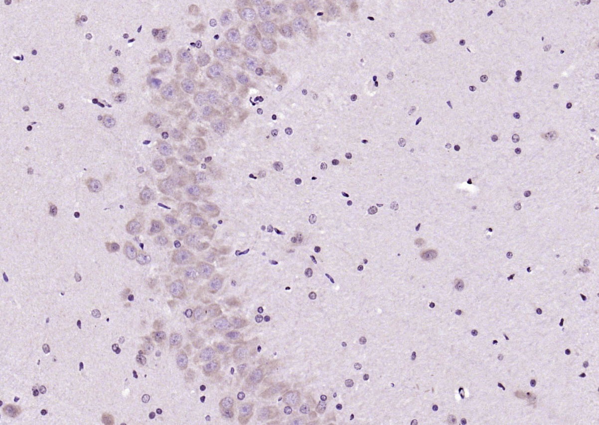 Anti-GABA Polyclonal Antibody