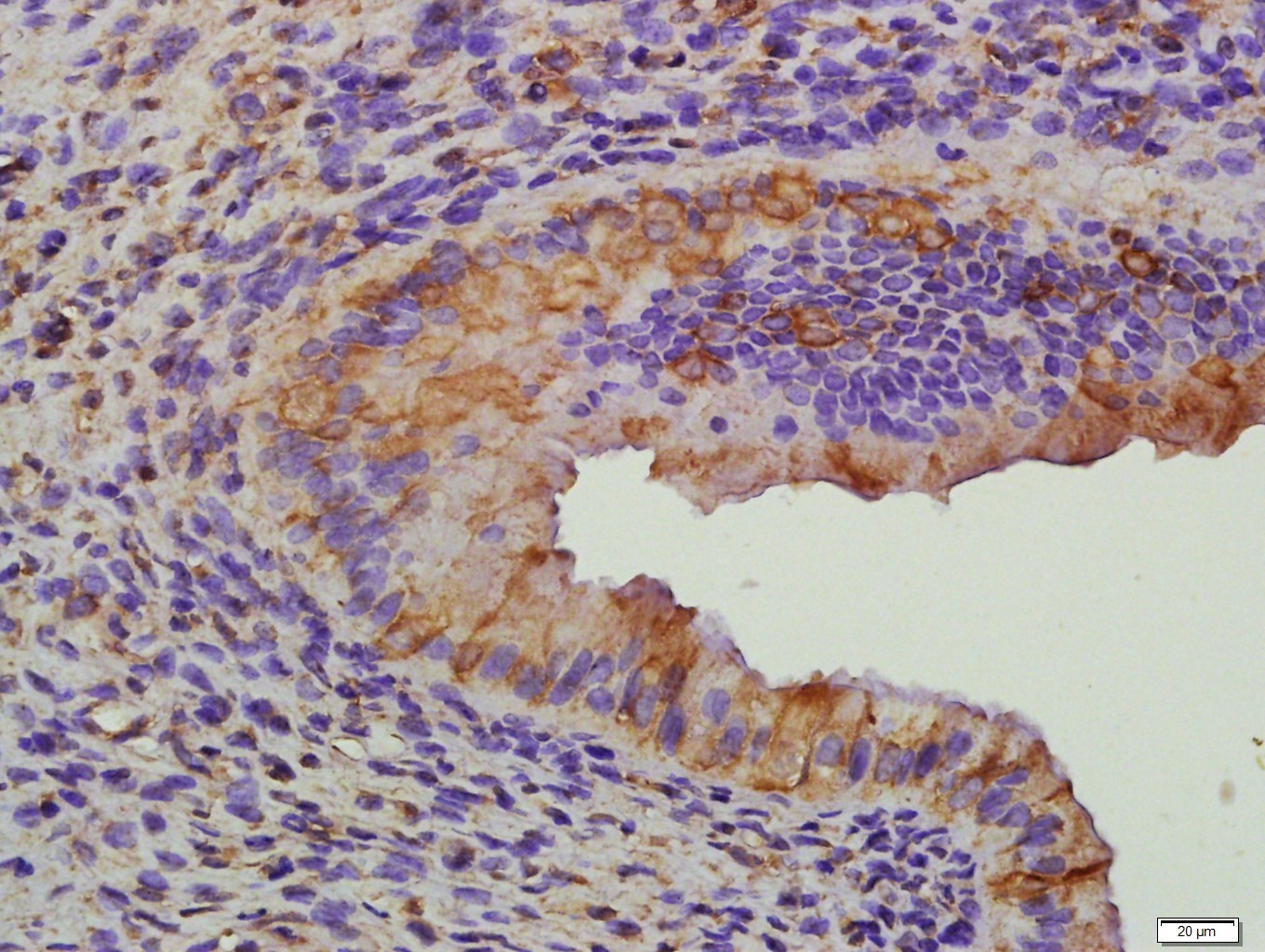 Anti-FSHR Polyclonal Antibody 2