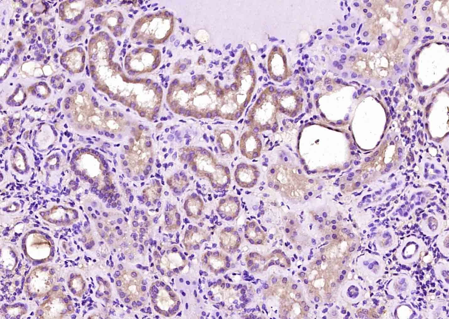 Anti-FOLR1 Polyclonal Antibody
