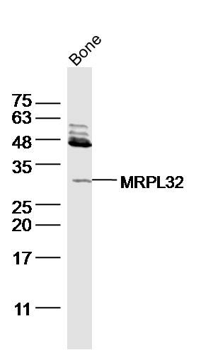Anti-FGF-23 Polyclonal Antibody