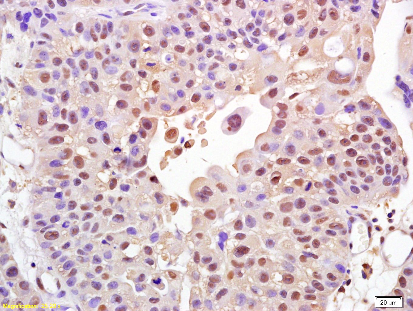Anti-FOXO1A Polyclonal Antibody