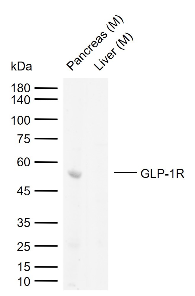 Anti-GLP1R Polyclonal Antibody